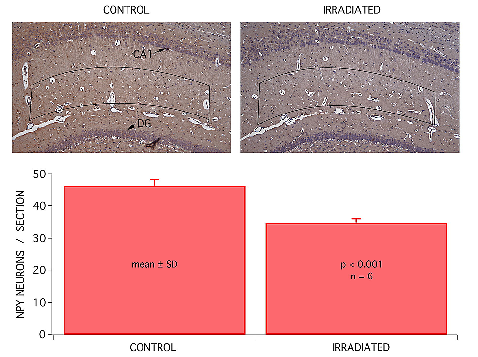 There-was-little-or-no-apparent-change-in-the-overall-anatomy-of-brain-tissue-in-the-CA1-region-of-the-hippocampus-(shown),-or-in-any-other-brain-region-at-the-gross-anatomy-level.