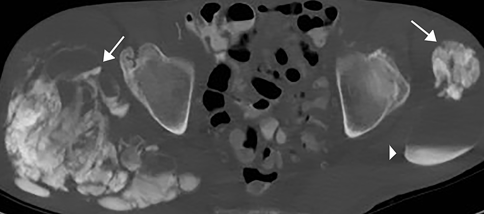 River Renal Dialysis