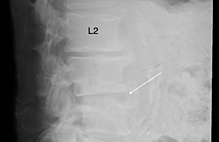 Article_box_b4c0518033fb11e7b4904d48af5b1fe8-figure-1rev