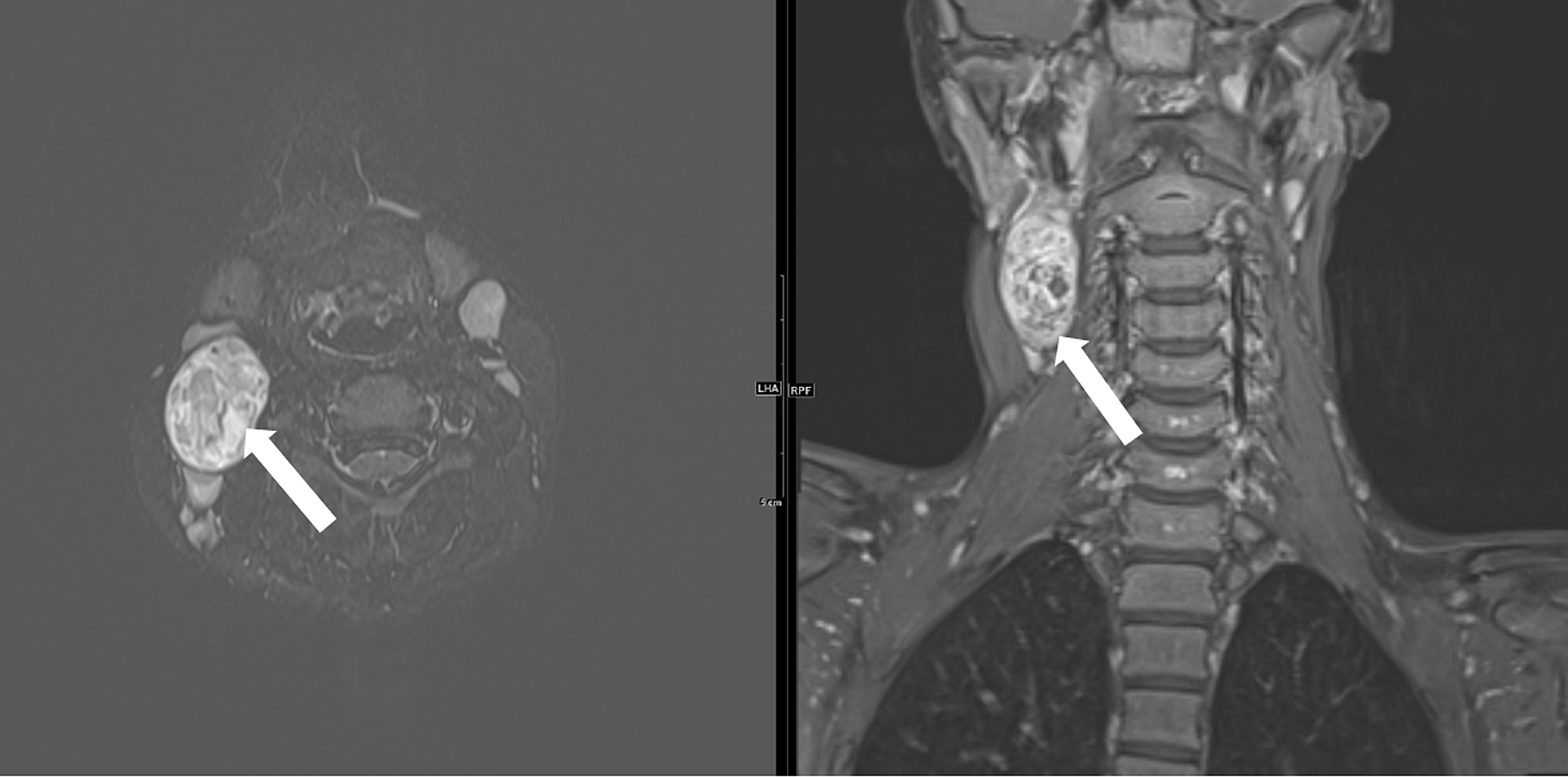 Cureus Multimodal Imaging Characteristics And Diagnostic Approach To