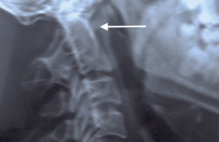 Article_box_02da9eb03aab11e79bac25d5cfebaf99-1