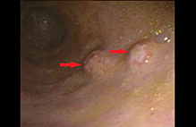 Article_box_e895c3b0545211e7bda9659670bbad3e-figure-1