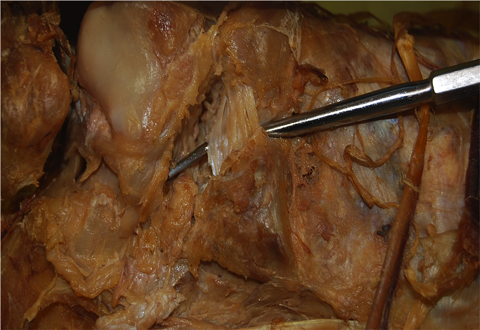 Figure-shown-as-an-enlargement-of-figure-1