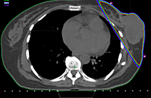 Article_box_3805bb30403a11e7a63a15dbb67b00be-screenshot-2017-05-23-22.33.24