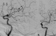 Article_box_bd02d27040b011e7974c6dafba85e6f2-figure-1