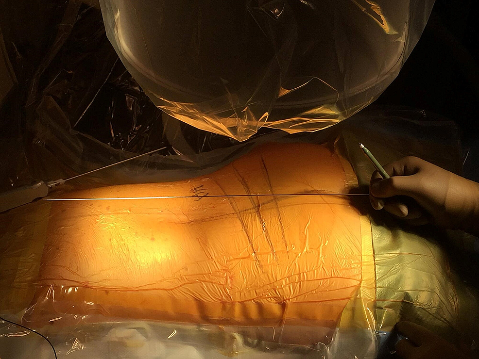 Identifying-disc-trajectory-without-alignment-of-the-endplates.