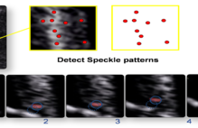 Article_box_6a433aa04efe11e7845e99c796fed397-figure-1_formatted_edited_v2-pme