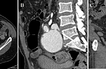 Article_box_275181204f8f11e7bede9556e71508a1-fig1