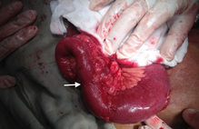 Article_box_ea2c0750507111e7825fdbec1fadca2c-figure-2