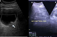 Article_box_9de76660528711e7a91977f50a692bf7-lightbox_25abe8704d1311e7b9514f77228f01f1-usg1