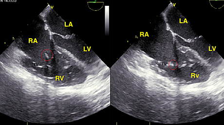 Content_card_a7fab140584d11e7b8e9379708ac323f-echo-3