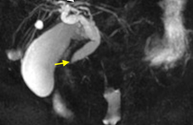 Article_box_188905b0583a11e7828b3715e3cf3b8c-33