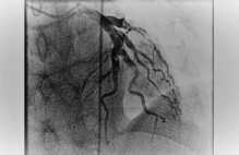 Article_box_0eb70ba05b5e11e78074f12a30c26d7c-slide1