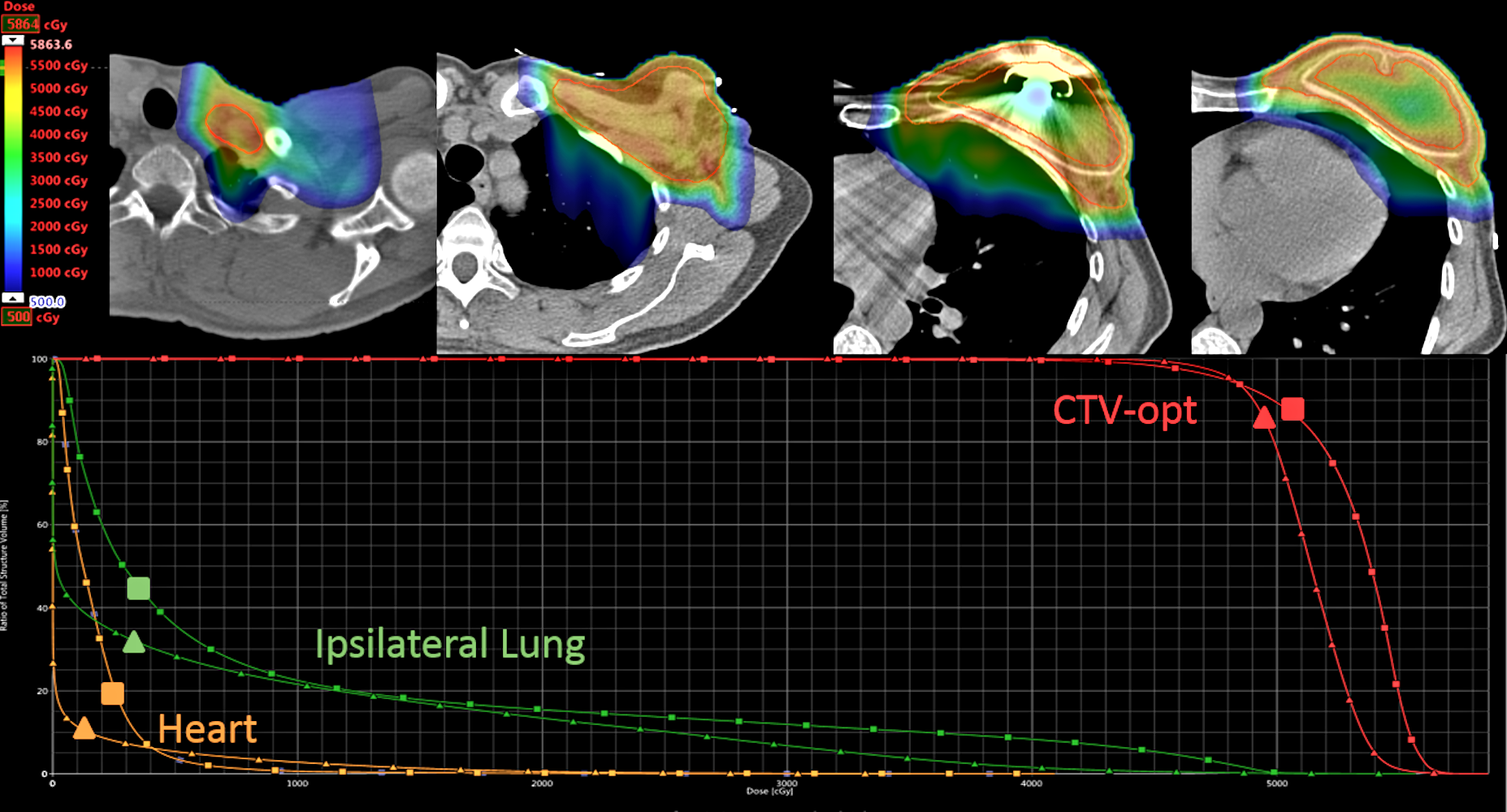 Cureus Field Specific Intensity Modulated Proton Therapy Optimization