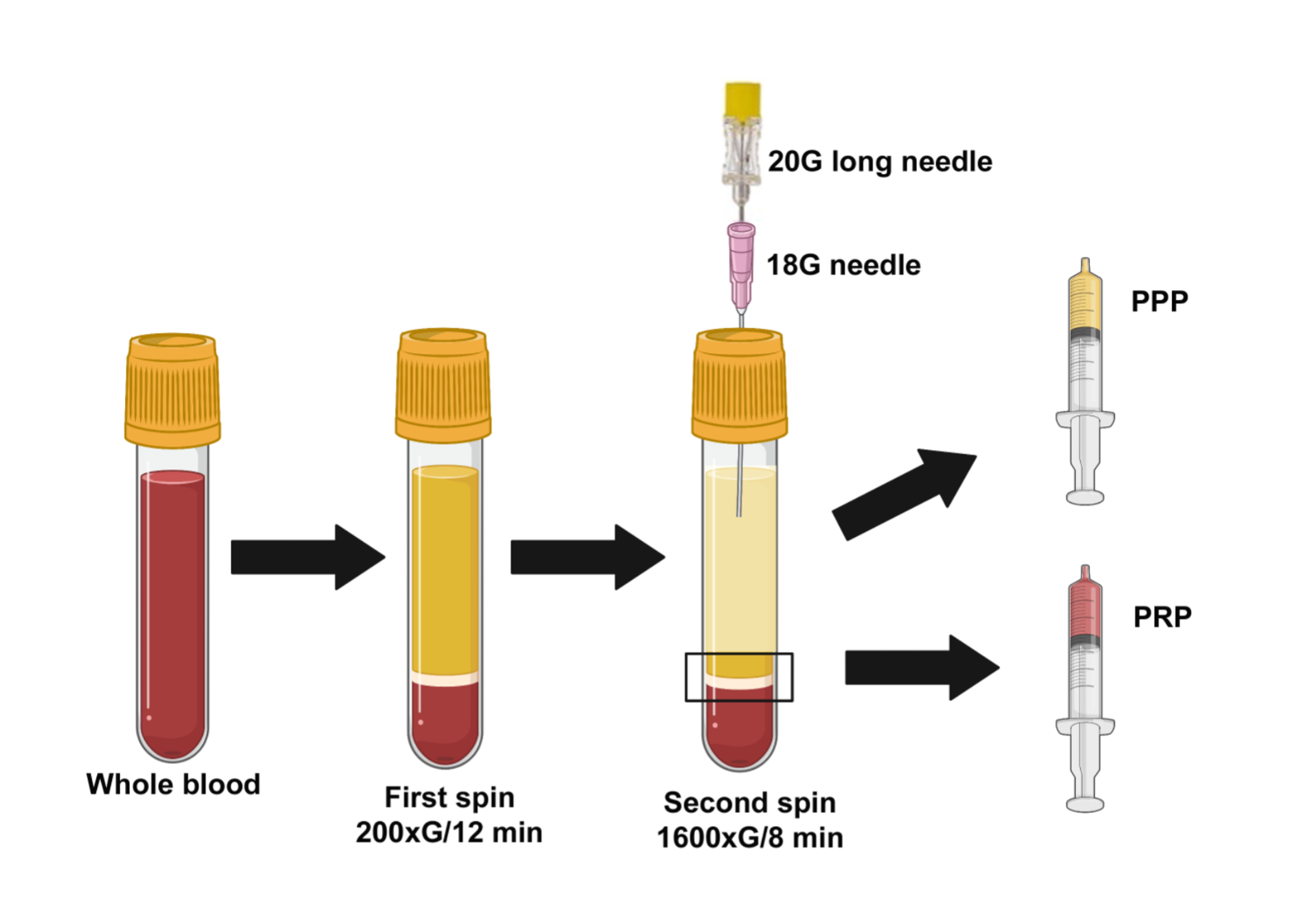Cureus A Simple Double Spin Closed Method For Preparing Platelet Rich