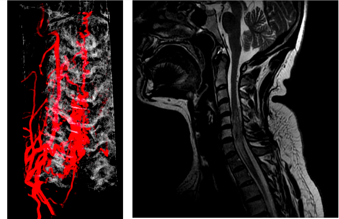 Clinical Neurology Aminoff Pdf Download