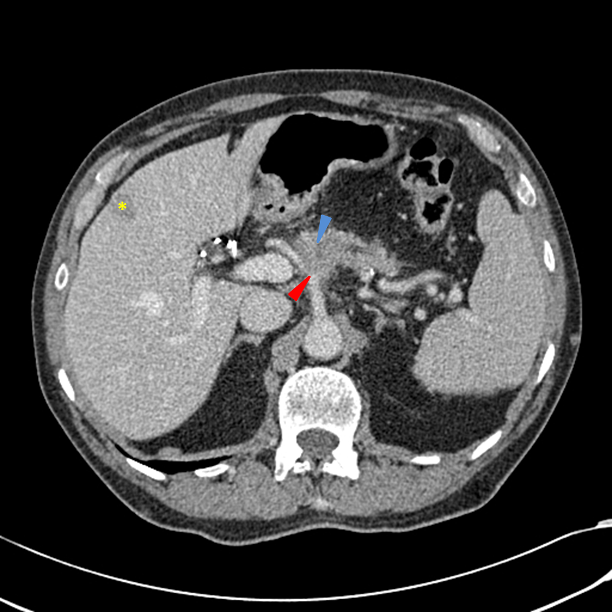 shotty lymph nodes change sizes when sick