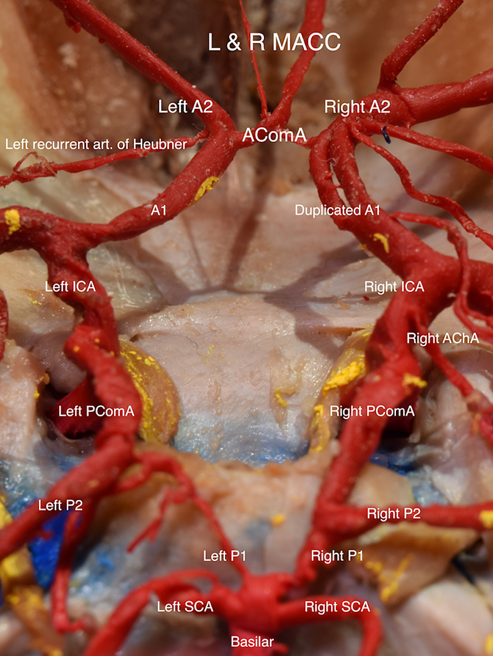 circle-of-willis.