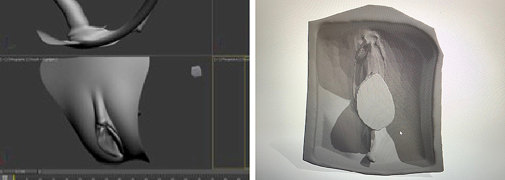 development of an anatomical silicone model for si
