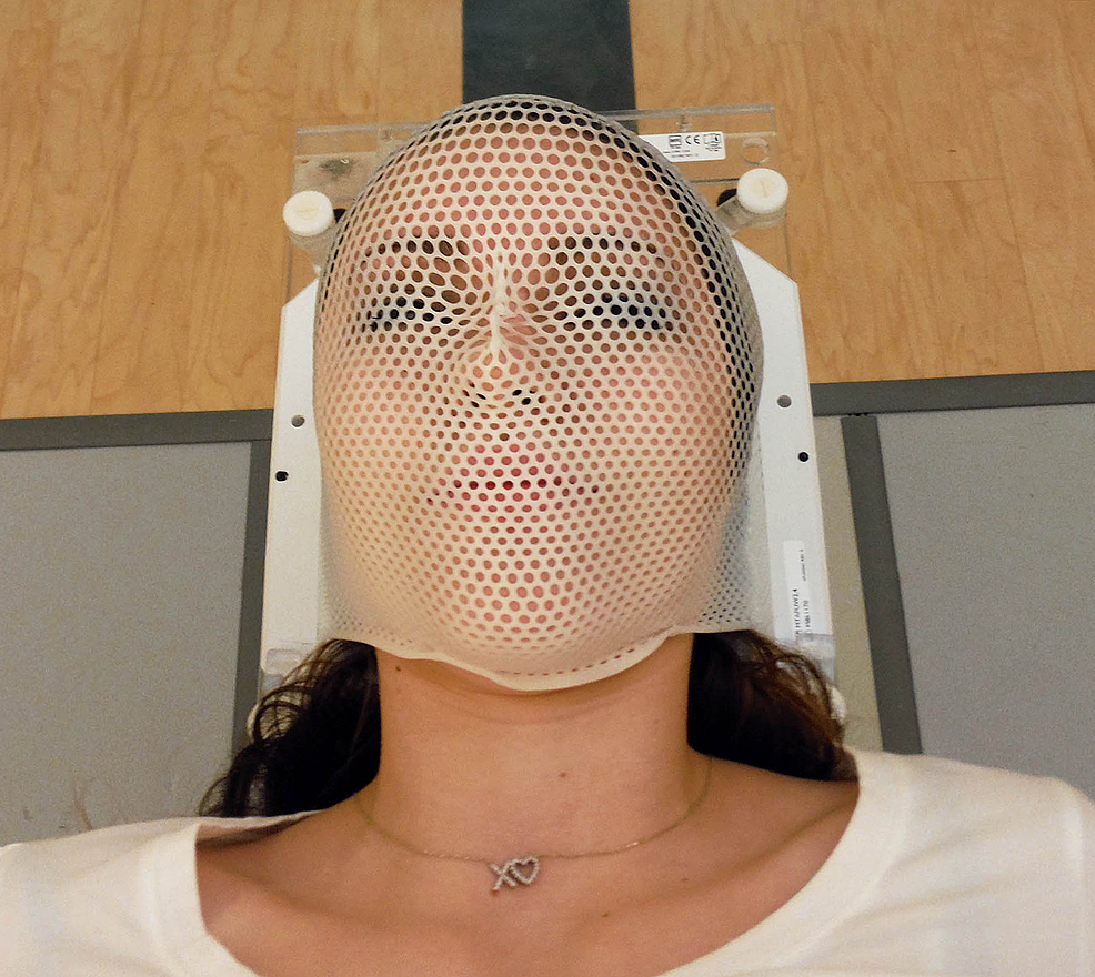 Cureus The Continuous Assessment of Cranial Motion in Thermoplastic