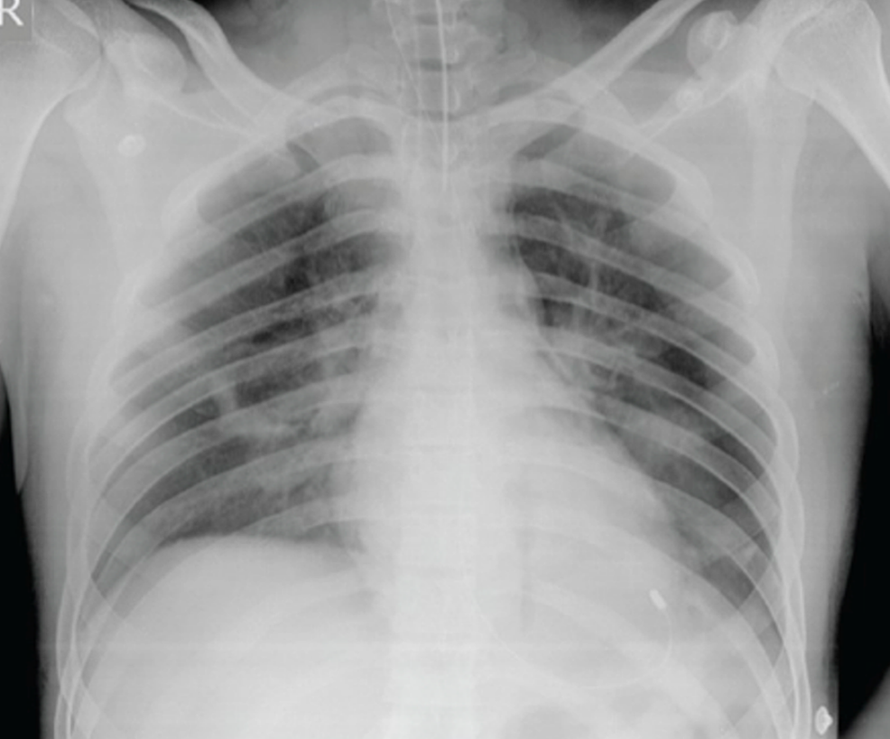 Cureus Smoke Inhalation in a Rural Emergency Setting A Simulation