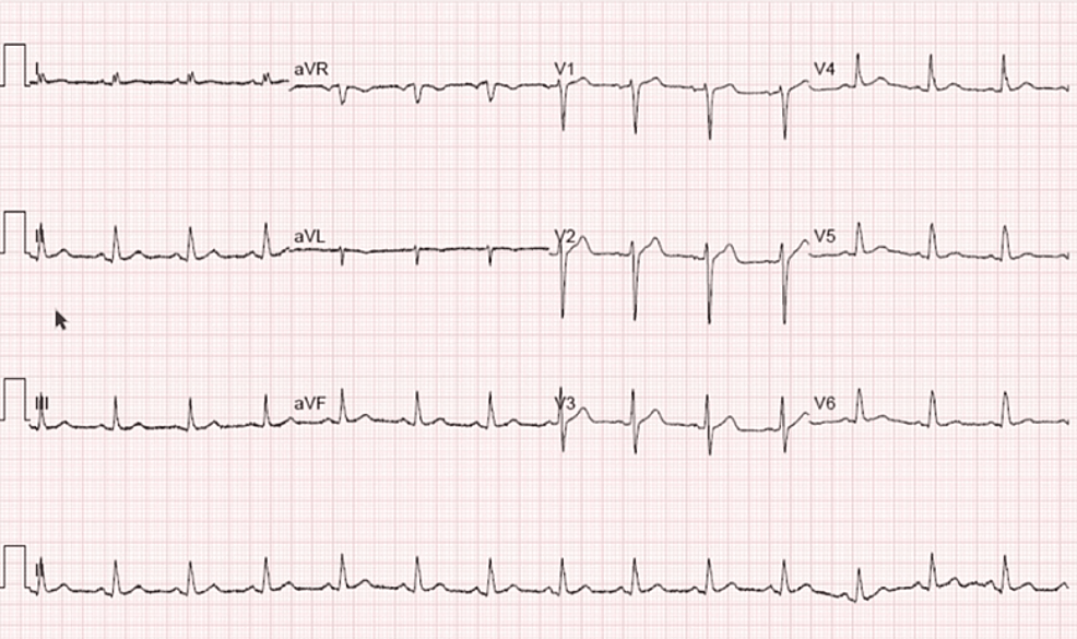 Cureus The Importance Of Advanced Imaging By Cardiac Magnetic