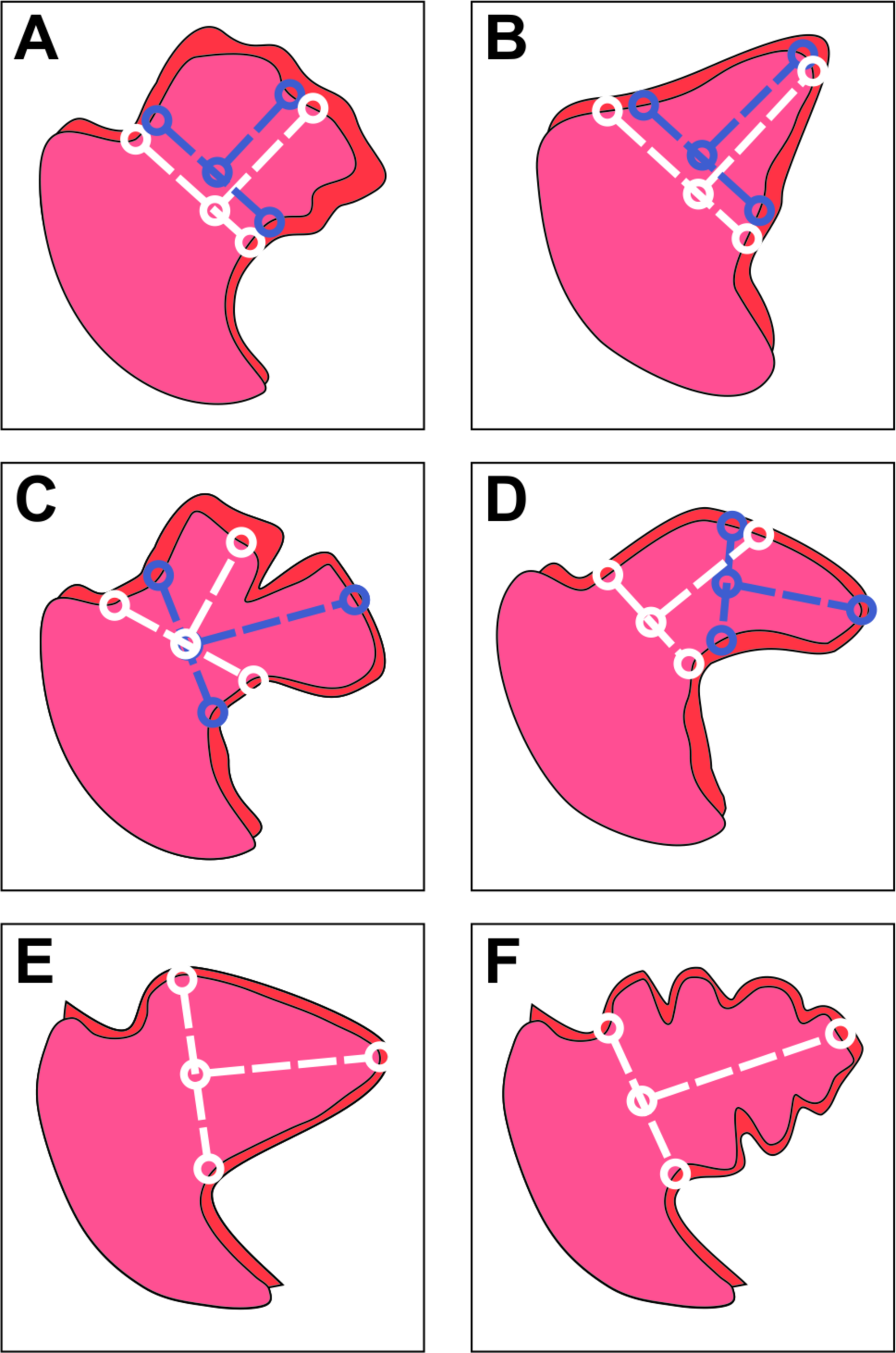 Cureus | Personalized Fluoroscopic Angles in Watchman™ Left Atrial ...