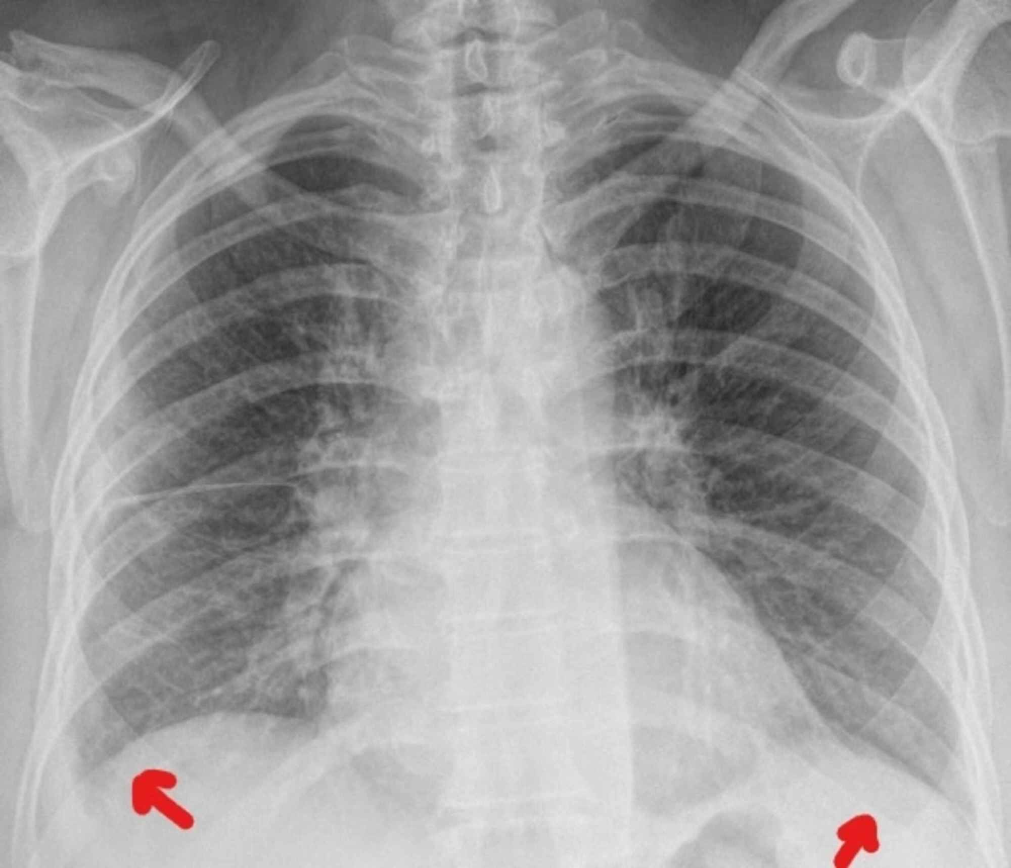 thoracic radiography