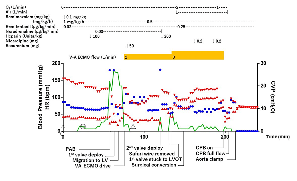 Anesthesia-chart