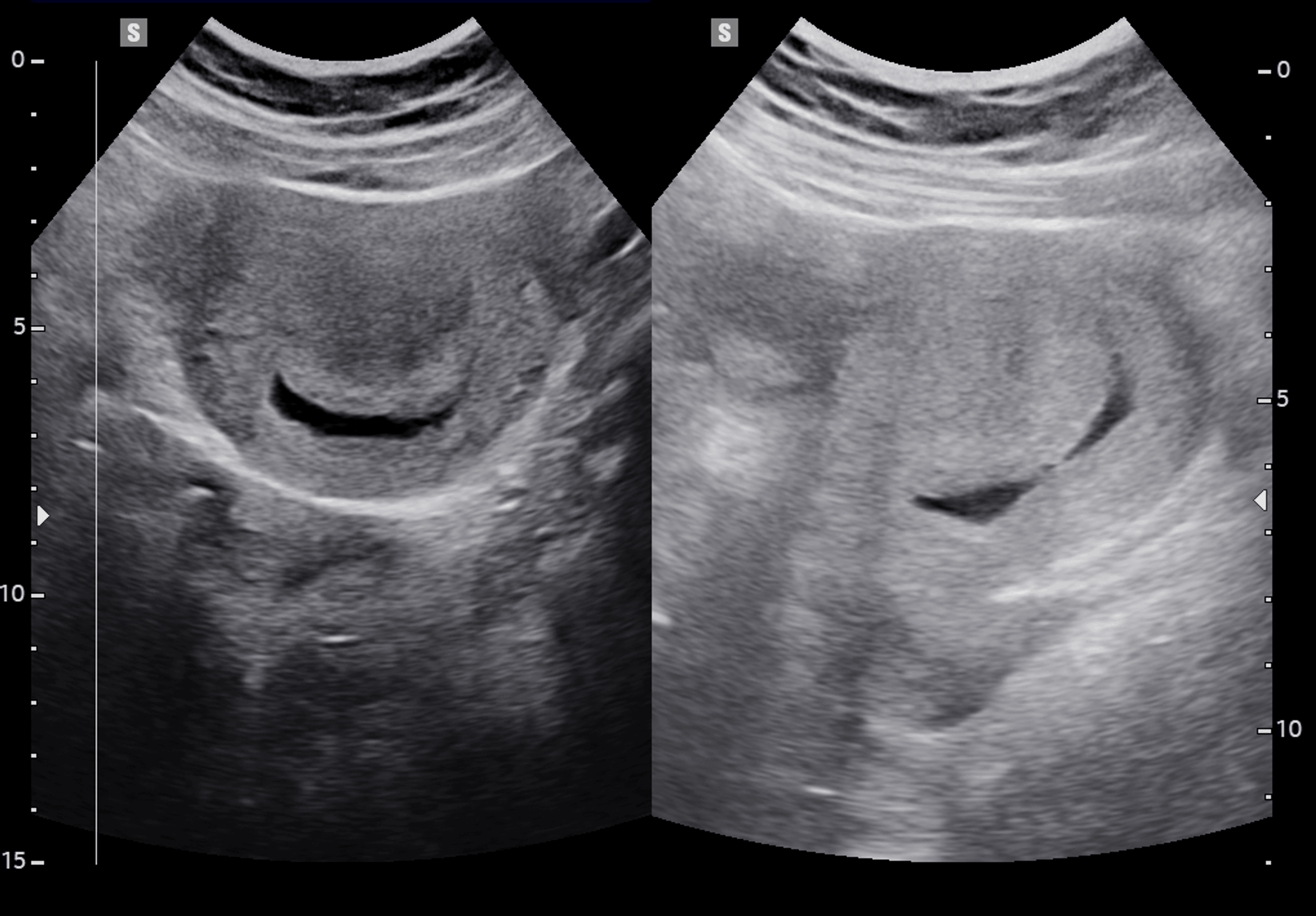 Pregnant Empty Sacjake Burton Stu - m5yp8l3