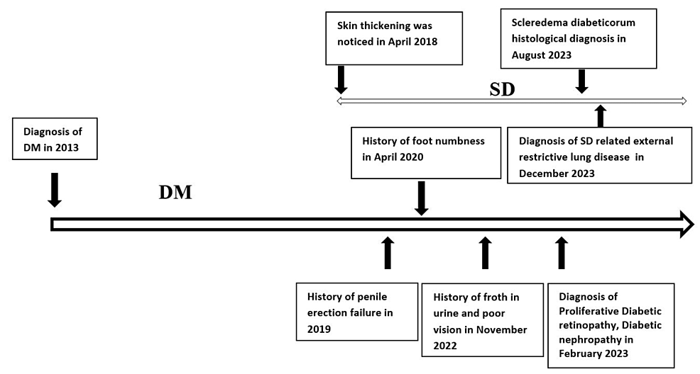 Cureus | Scleredema Diabeticorum: A Rare Metabolic Connective Tissue ...