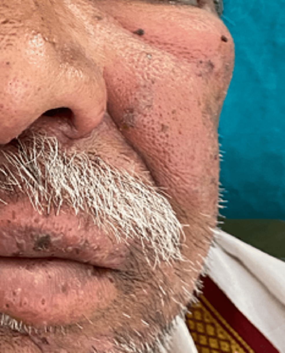 klower lip twitches reddit New muscle twitching in face when I smile/grin Lower lip twitching : r/MuscleTwitch