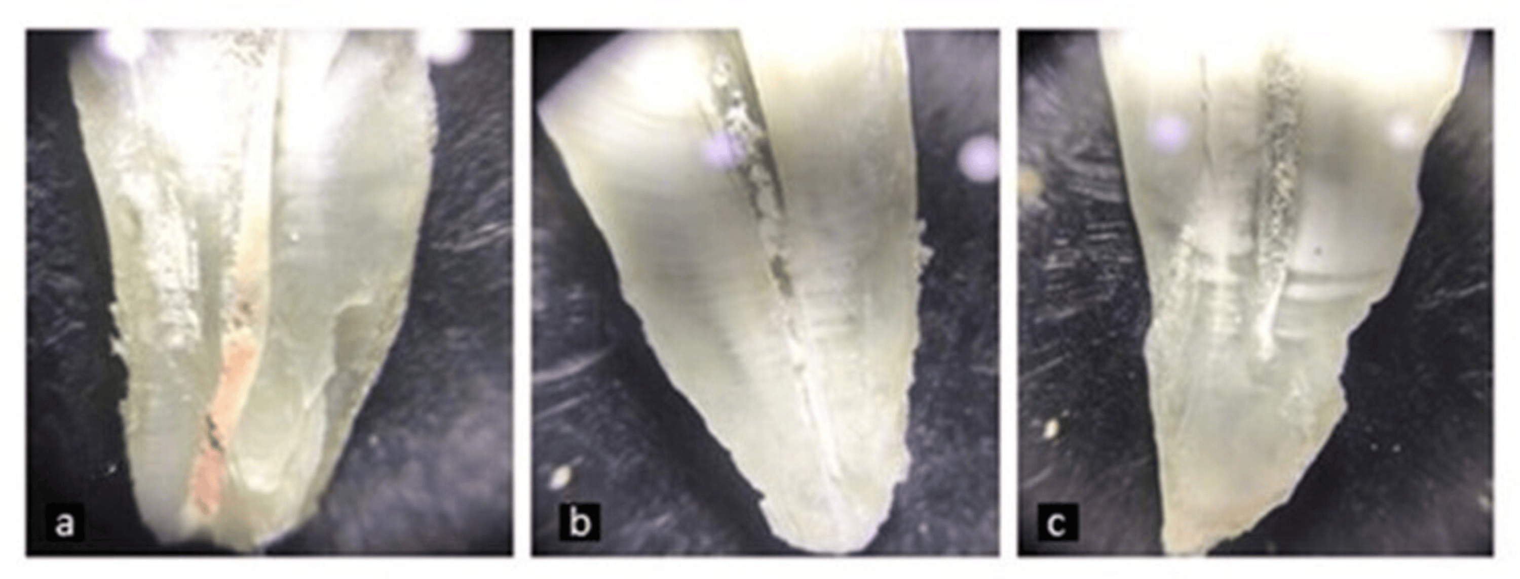 Comparative Evaluation of the Removal of Gutta Percha From the Root
