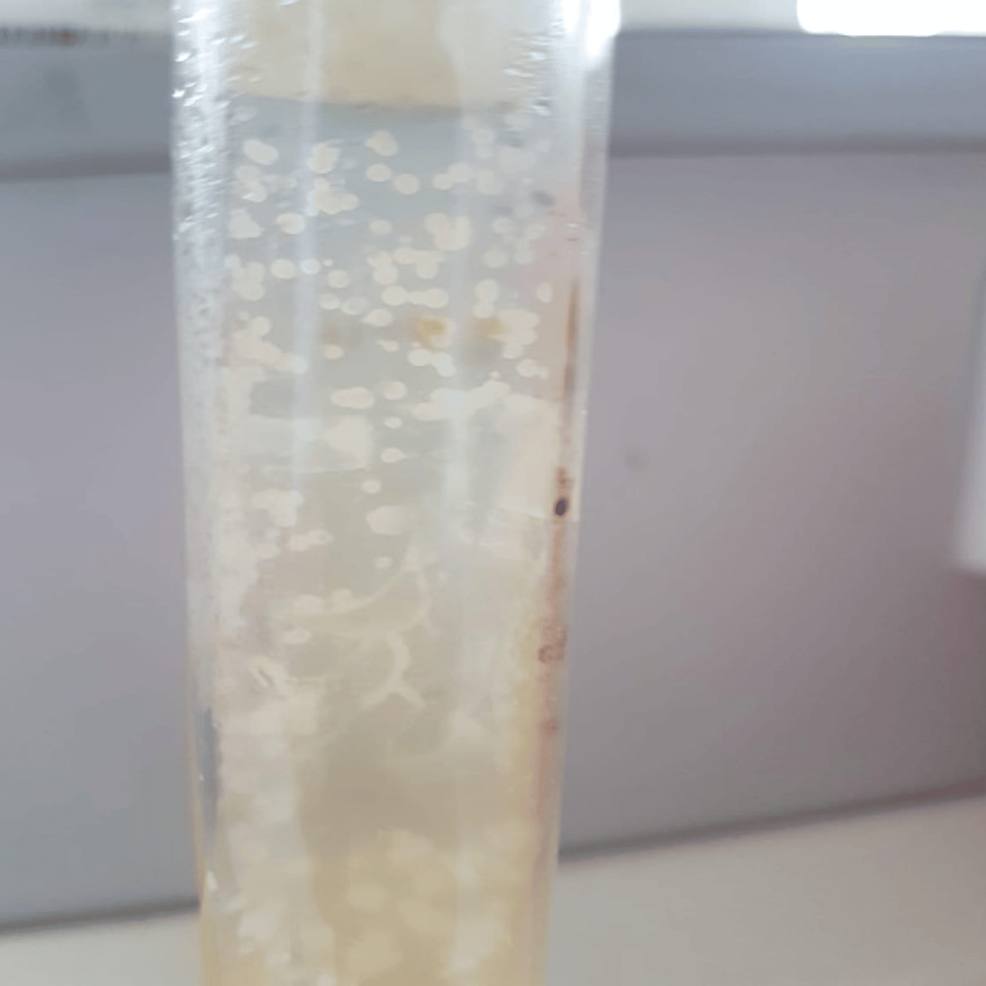 Candida tropicalis Fungal Keratitis: A Case Report and Literature Review |  Cureus