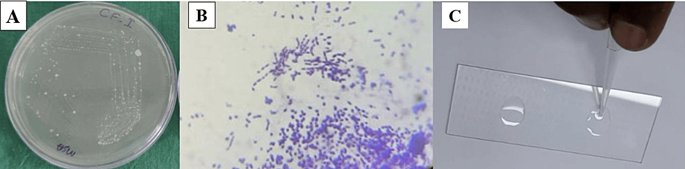 口腔悪性疾患（OPMD）患者から分離された Streptococcus mutans におけるミュータシン遺伝子型の頻度