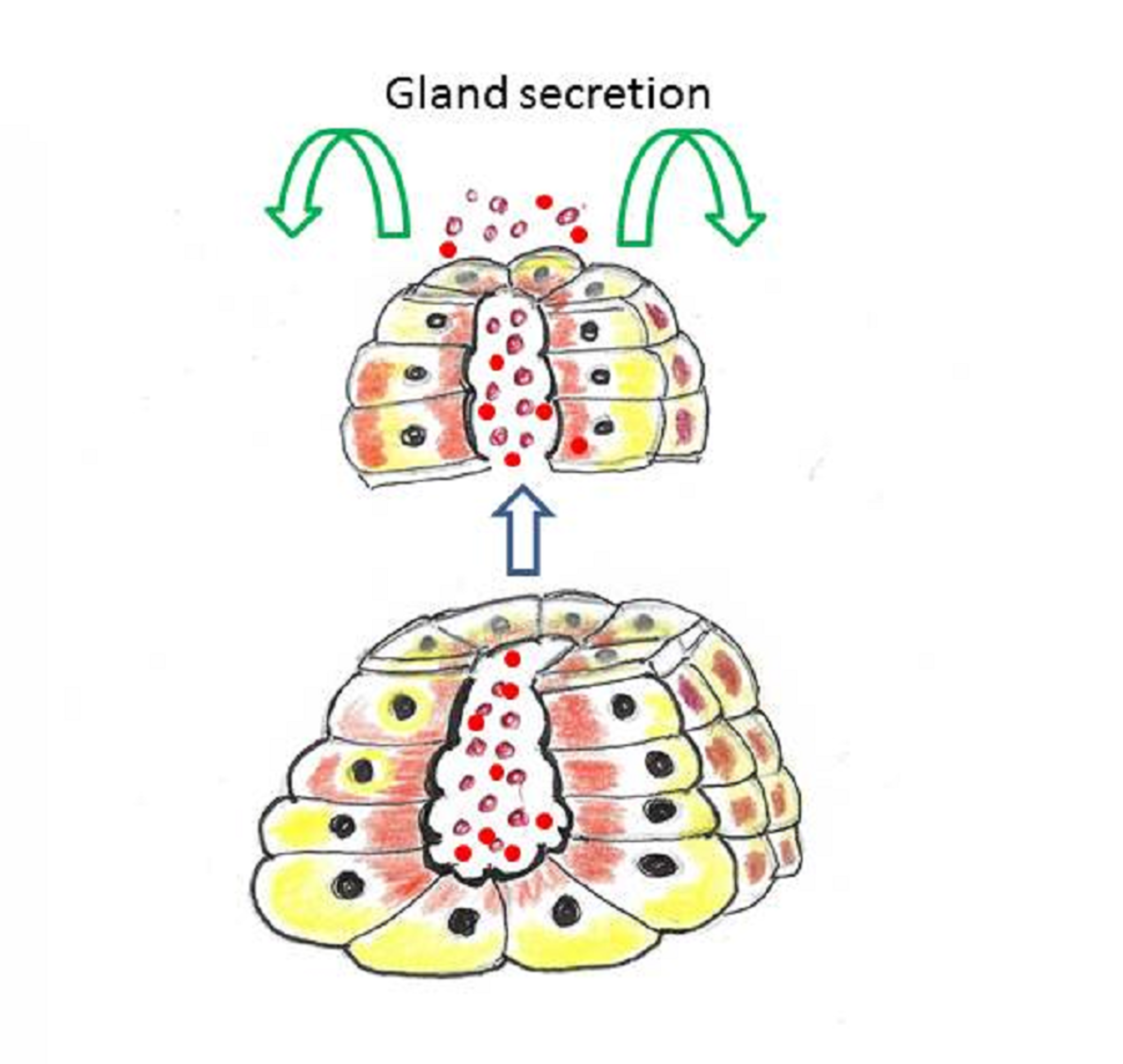 Cureus Breast Atypical Apocrine Adenosis A Case Report and