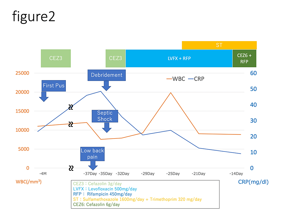 Cureus A Case of Significant Coagulopathy Due to Vitamin K Deficiency