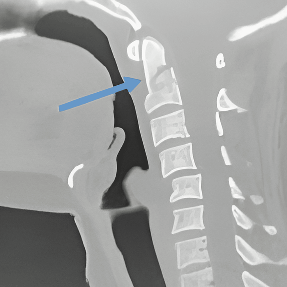 【裁断済み】How to Endodontics The State of th 裁断済み】How to Endodontics The State of th Root Canal