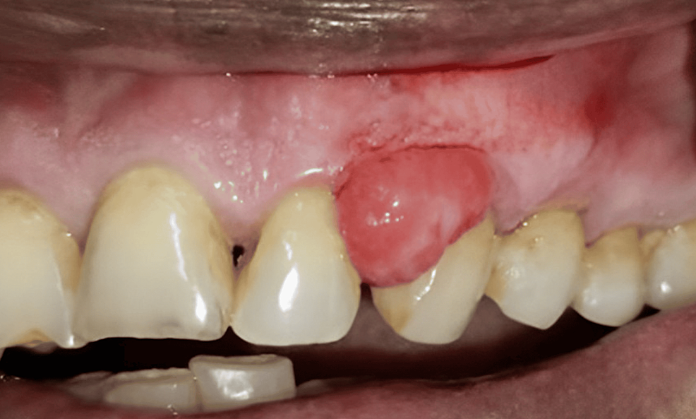dental
