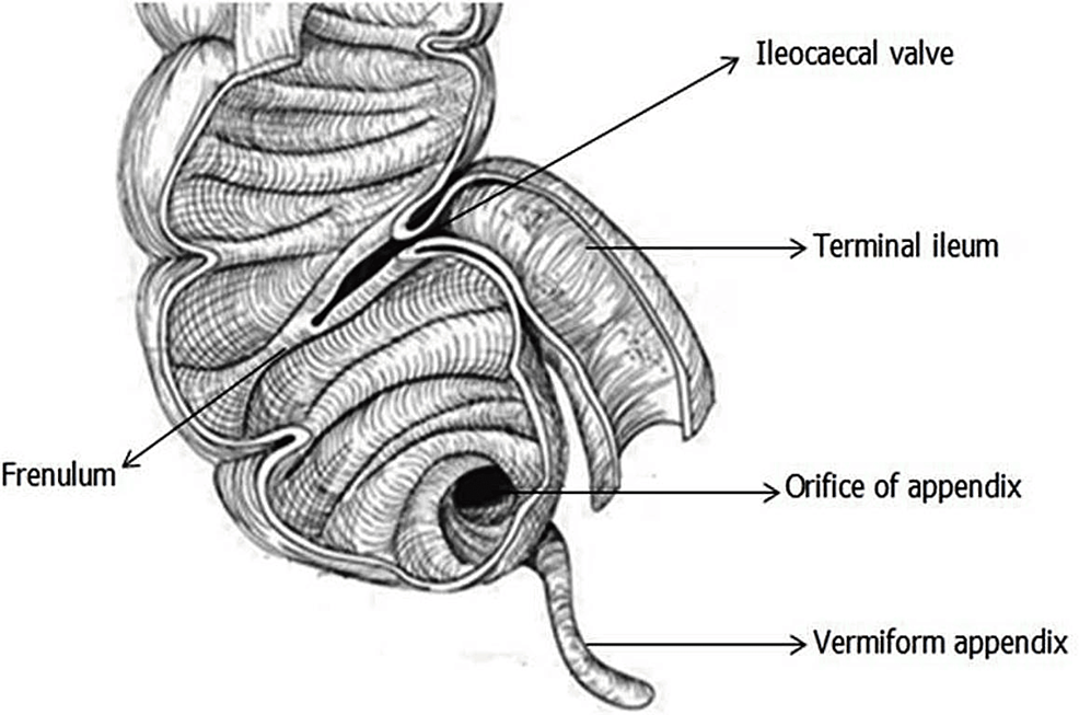 Assessment of the Anatomical Morphology of the Ileocecal Junction and ...