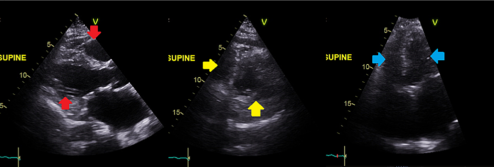 Файл cxr corona как открыть