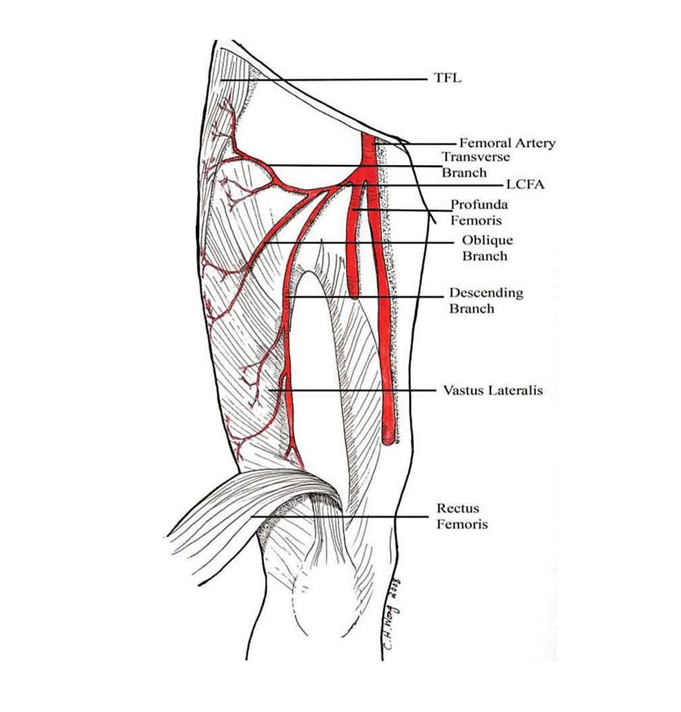 Cureus | Anatomic Variations of the Deep Femoral Artery and Its ...