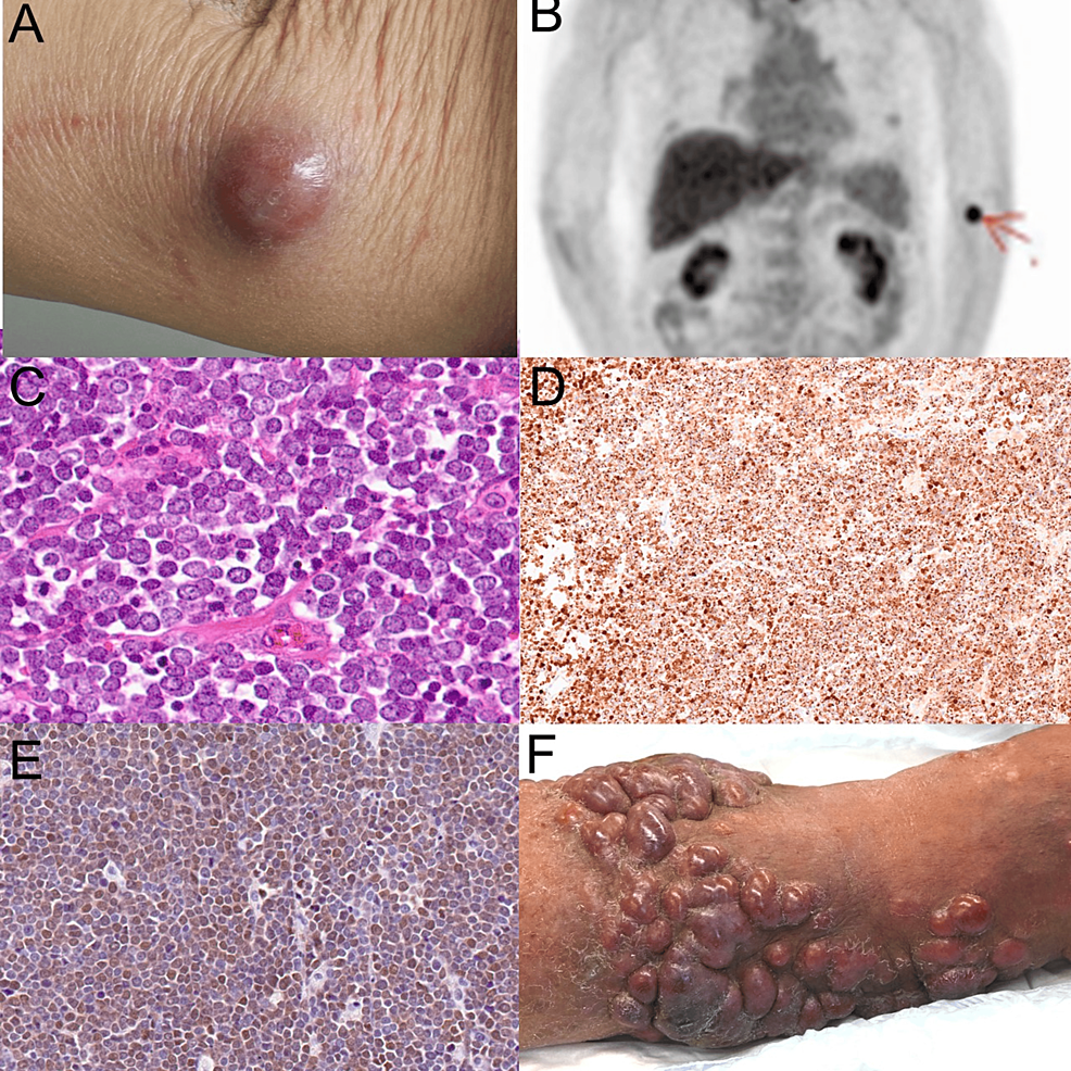 Clinical-manifestation-and-histological-examination