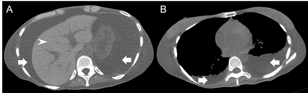 Simple-computed-tomography-(CT)