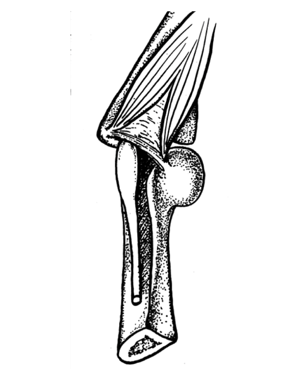 Cureus Osborne’s Ligament A Review of its History, Anatomy, and