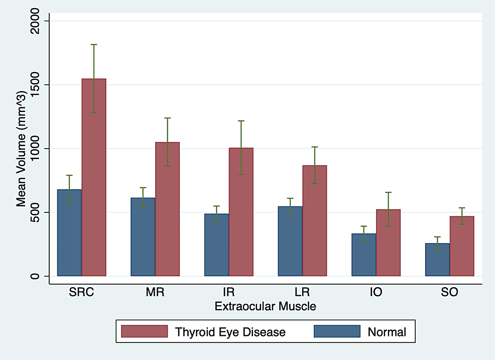 Extraocular Muscle Enlargement in Thyroid Eye Disease Using Volumetric ...