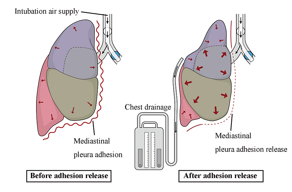 Hypothesis-of-the-pathophysiology-of-this-disease.