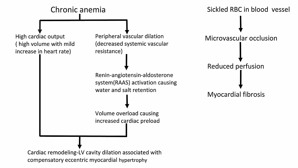 Sickle-Cell Disease Pathophysiology