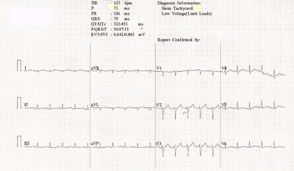 Diagnostic and Therapeutic Strategies in Evans Syndrome: A Case Report ...