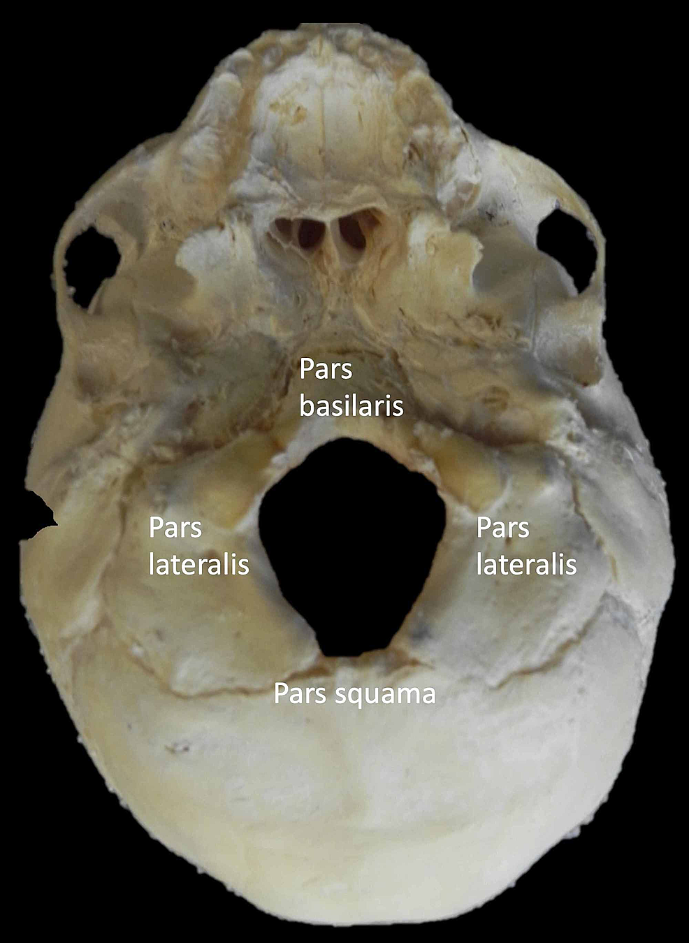 Occipital Bone And Foramen Magnum Neuroanatomy The Ne 9482